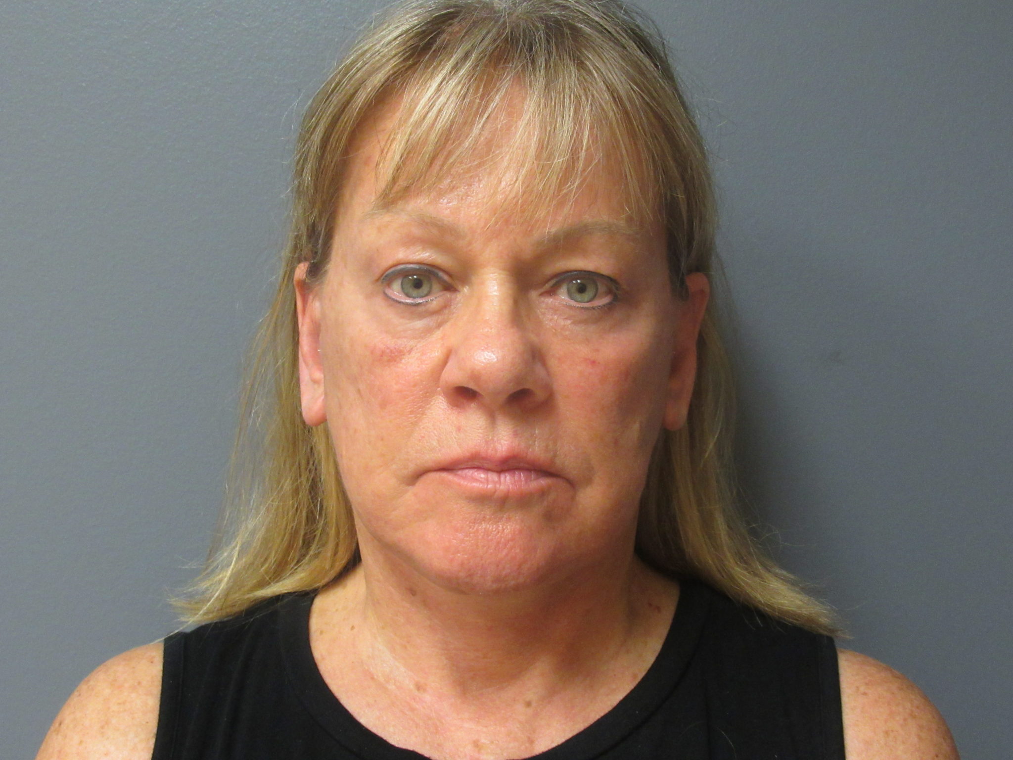 Facelift Brow Lift Neck Lift Aesthetic Plastic Surgery & Laser