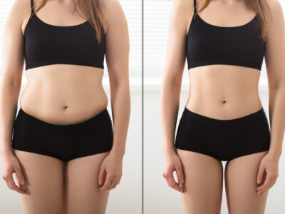 body lift Close-up Of Fat And Slim Woman Standing Opposite To Each Other