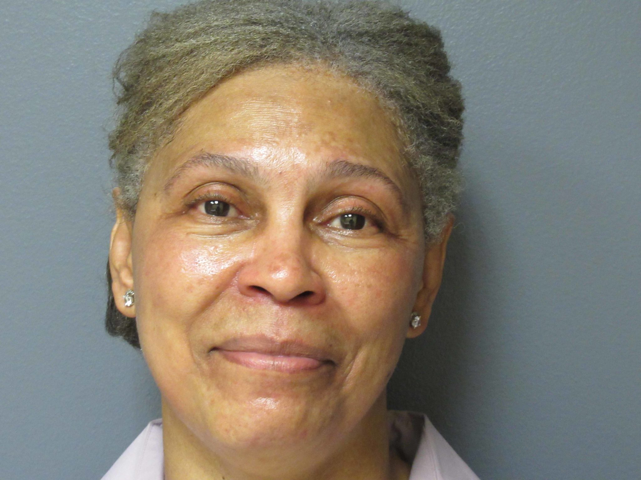 Fraxel Laser Aesthetic Plastic Surgery & Laser Center, Michelle