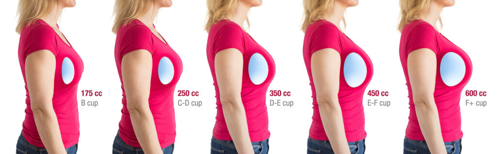 various Breast Augmentation implant sizes