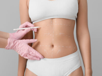 tummy tuck vs mommy makeover