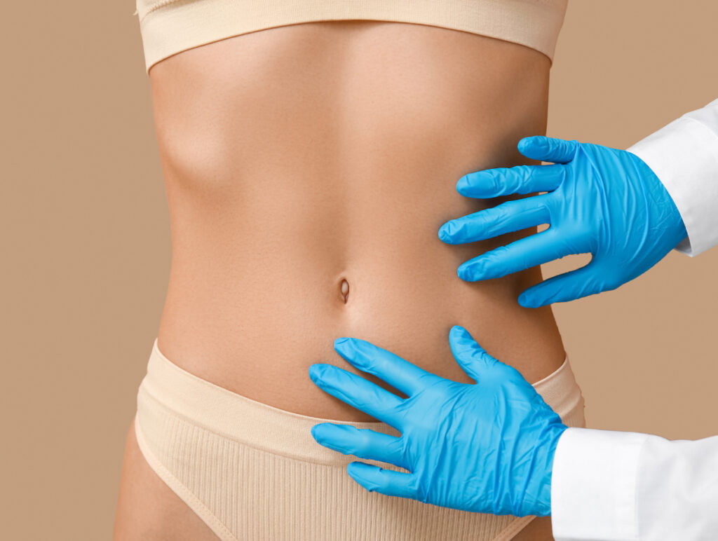 tummy tuck procedure