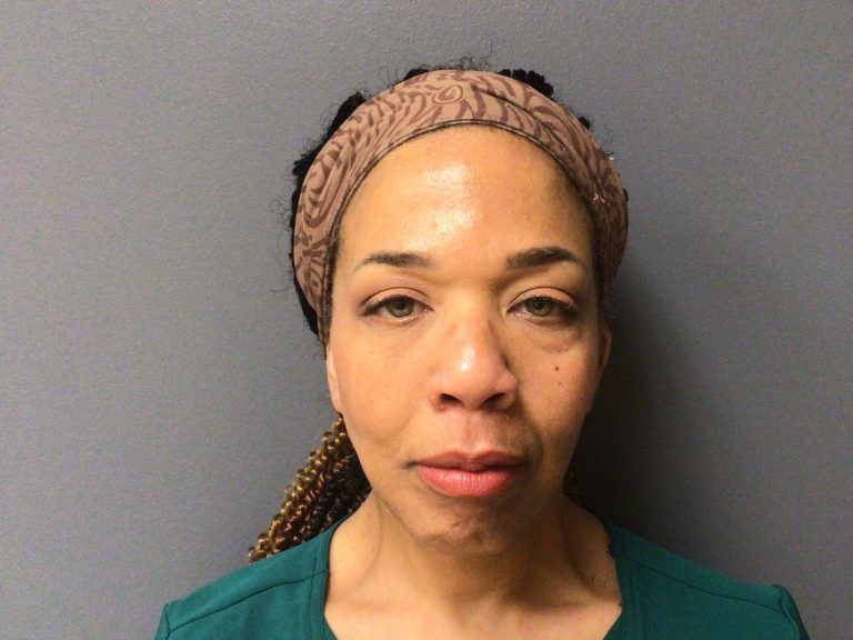 Facelift case 02, front view three months after surgery