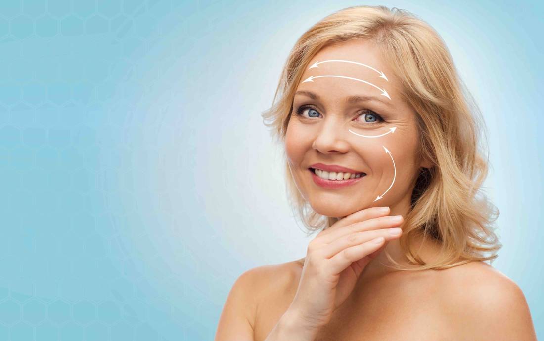 Facelift