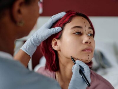 Woman gets markings for cosmetic surgery - Michelle Hardaway M.D.