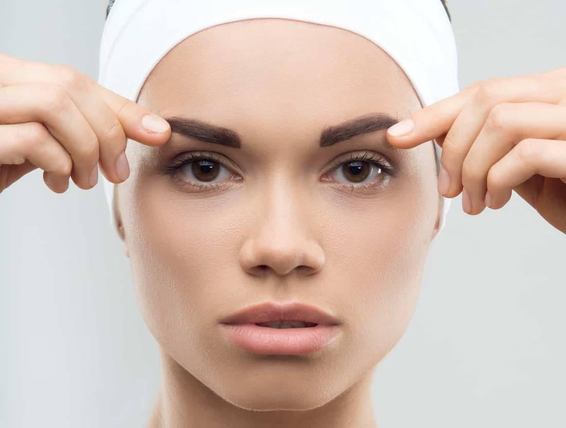 Brow lift