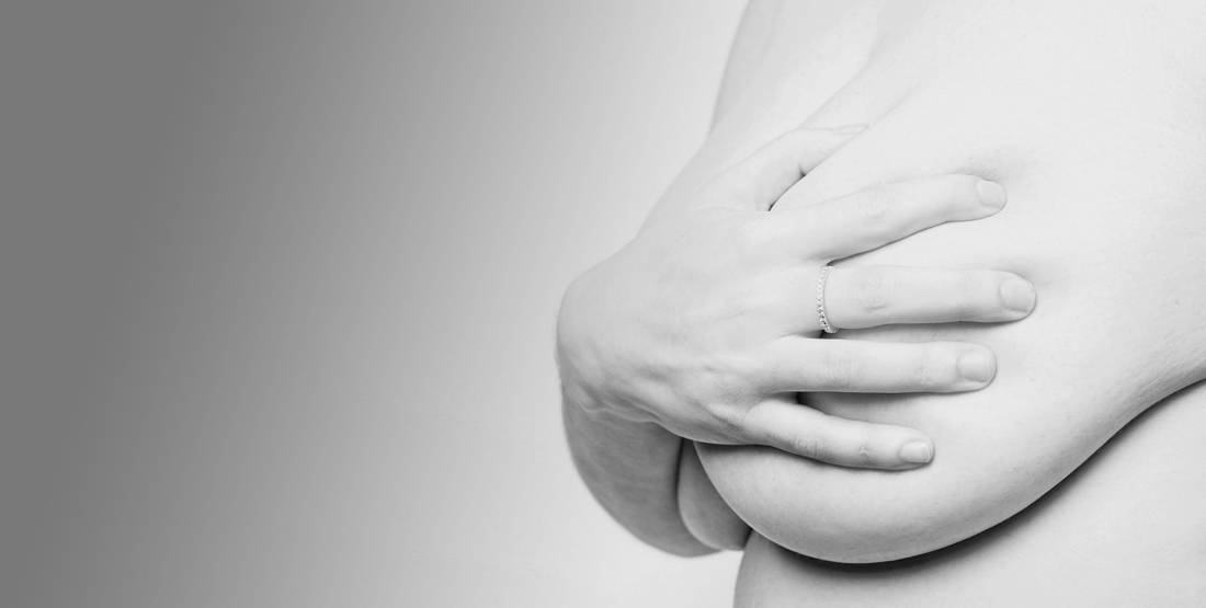 Breast reduction at Aesthetic Plastic Surgery & Laser Center