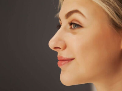Side profile of a blonde woman - Michelle Hardaway M.D.